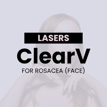 Sciton ClearV® for Rosacea - Face