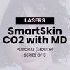 SmartSkin® CO2 – Perioral (3)