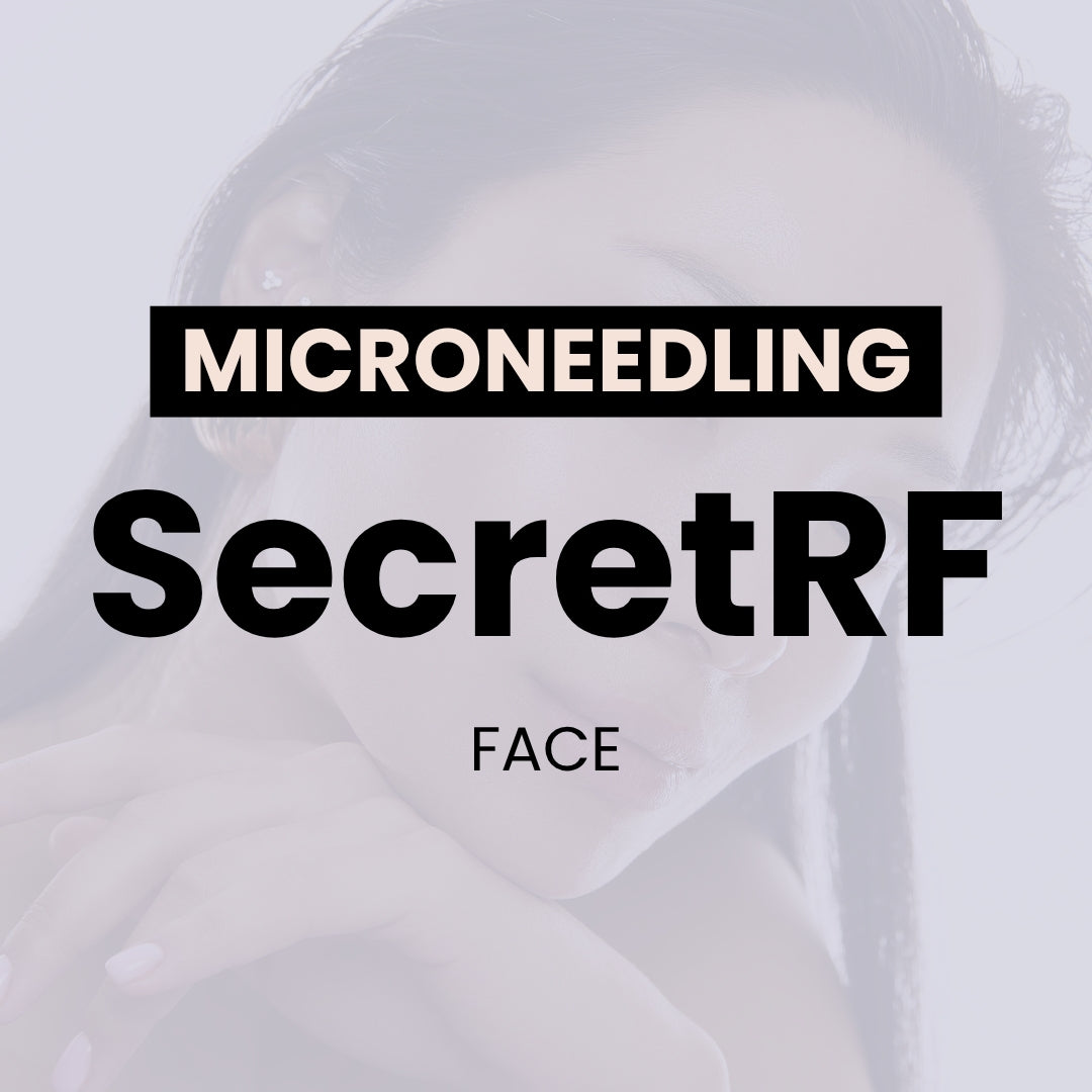 SecretRF Microneedling - Face (Single)