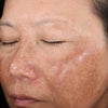 The Rejuvenize Peel®