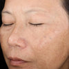 The Rejuvenize Peel®