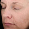 The Vitalize Peel®