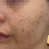 Secret™ PRO Ultra Lite - Face
