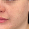 Secret™ PRO Ultra Lite - Face