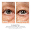 Renewal Eye Cream by Epionce®